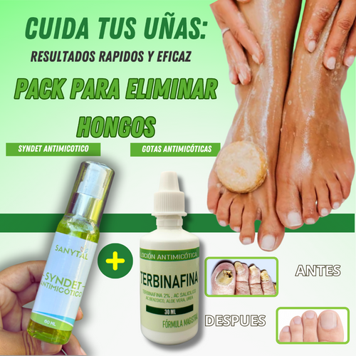 PACK ANTIMICOTICO (GOTAS DE TERBINAFINA + JABON ANTIMICOTICO (SYNDET) (ELIMINA HONGOS EN LAS UÑAS Y PIE DE ATLETA)- M0261