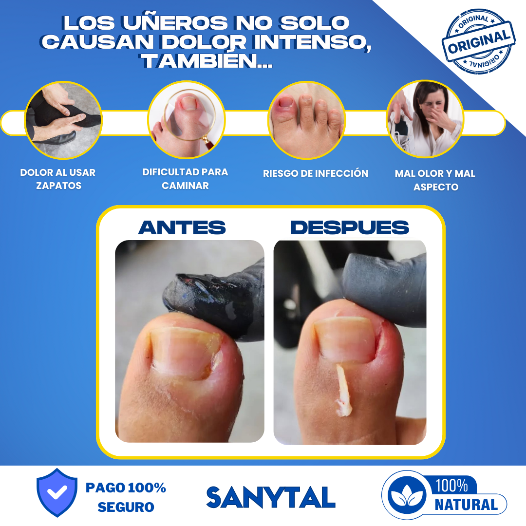 PACK PARA UÑEROS SIN DOLOR - (SPRAY ANESTÉSICO ANESTEK PRO + HERRAMIENTAS PODOLOGICAS)