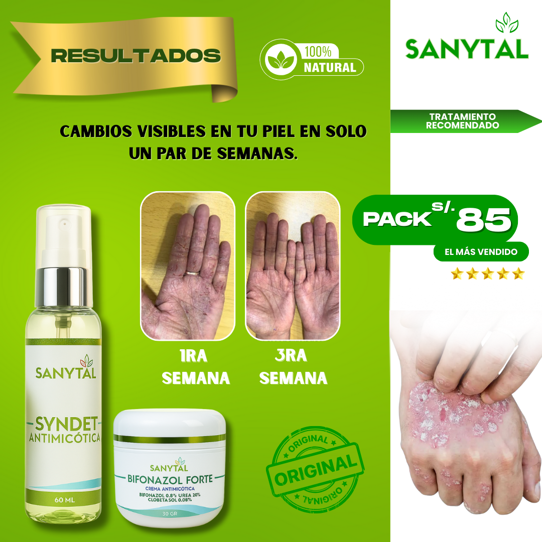 PACK ELIMINA TIÑA E INFECCIONES POR HONGO EN LA PIEL (BIFONAZOL FORTE + JABÓN ANTIMICOTICO SYNDET)- B01