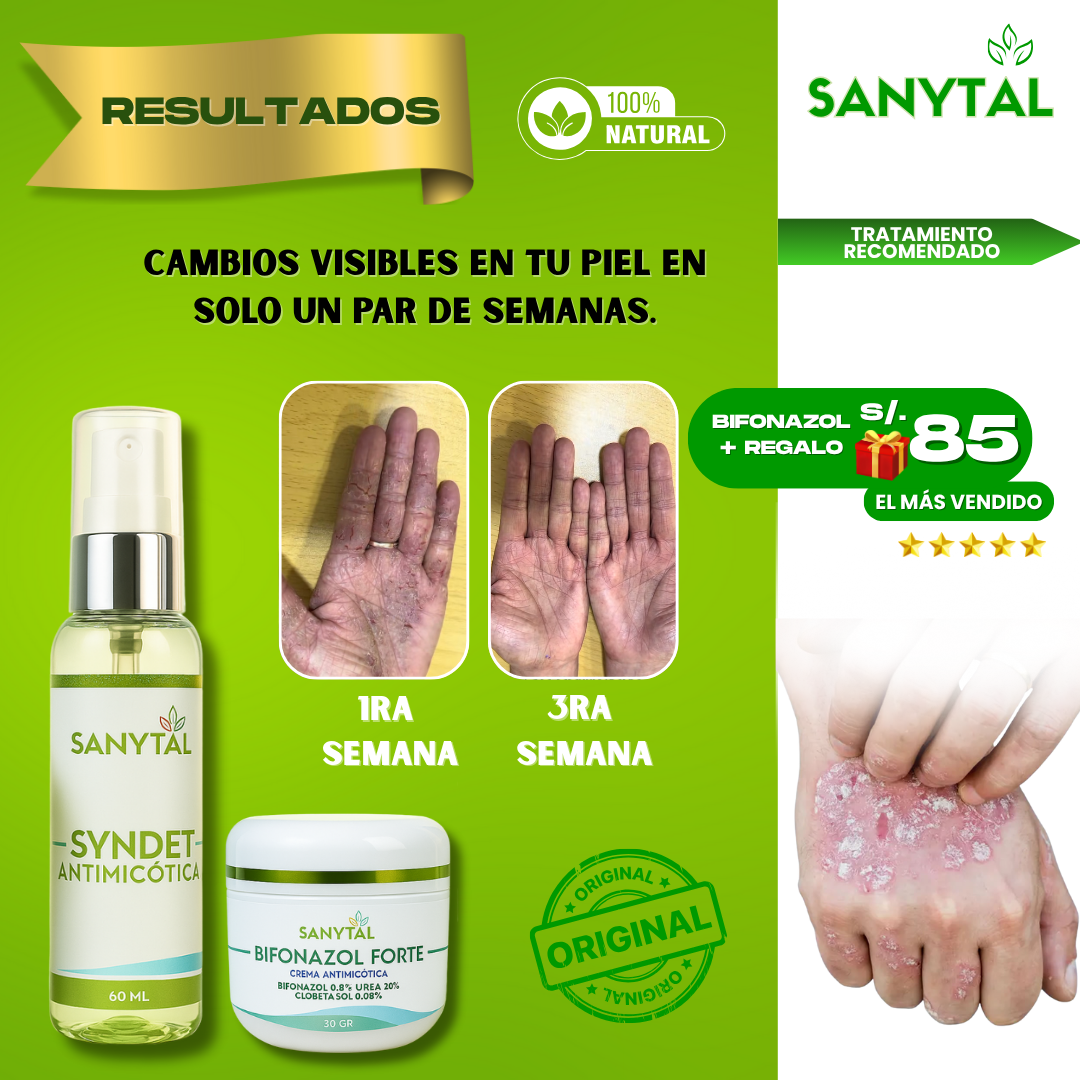 PACK ELIMINA TIÑA E INFECCIONES POR HONGO EN LA PIEL (BIFONAZOL FORTE + JABÓN ANTIMICOTICO SYNDET)- B02