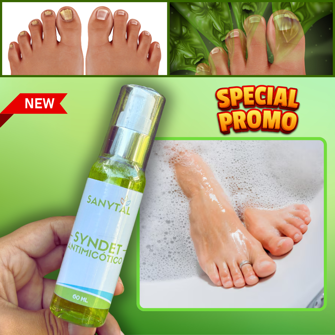 PACK ANTIMICOTICO (GOTAS DE TERBINAFINA + JABON ANTIMICOTICO (SYNDET) (ELIMINA HONGOS EN LAS UÑAS Y PIE DE ATLETA)- M0248