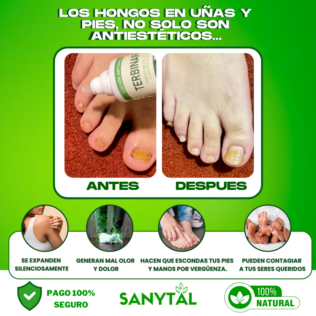 PACK ANTIMICOTICO (GOTAS DE TERBINAFINA + SYNDET ANTIMICOTICO)- T01