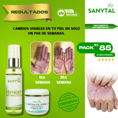 PACK ELIMINA TIÑA E INFECCIONES POR HONGO EN LA PIEL (BIFONAZOL FORTE + JABÓN ANTIMICOTICO SYNDET)- B01