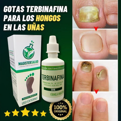 PACK ANTIMICOTICO (GOTAS DE TERBINAFINA + JABON ANTIMICOTICO (SYNDET) (ELIMINA HONGOS EN LAS UÑAS Y PIE DE ATLETA)- M0261
